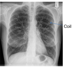 Xray